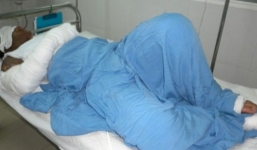 Nghi quan hệ ngoài luồng, vợ tạt cả ca axit vào mặt chồng